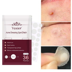 🩹 Invisible Acne Healing Patches (36 Stickers) لصقات حب الشباب الخفية (٣٦ قطعة)