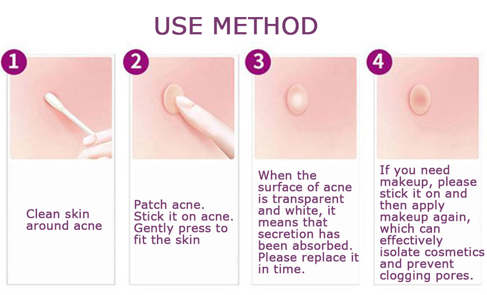 🩹 Invisible Acne Healing Patches (36 Stickers) لصقات حب الشباب الخفية (٣٦ قطعة)