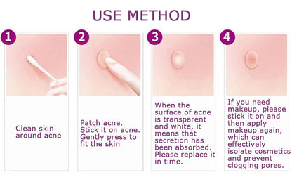 🩹 Invisible Acne Healing Patches (36 Stickers) لصقات حب الشباب الخفية (٣٦ قطعة)