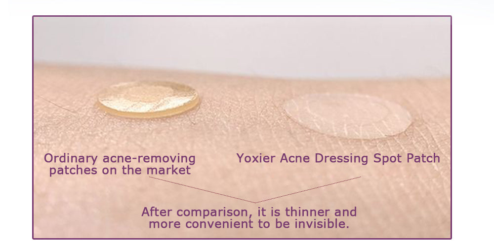 🩹 Invisible Acne Healing Patches (36 Stickers) لصقات حب الشباب الخفية (٣٦ قطعة)